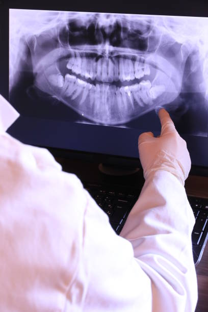 Best Dental Abscess Treatment in Lakeview, MI